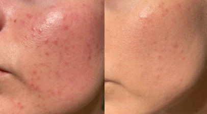 نتائج قبل وبعد 1